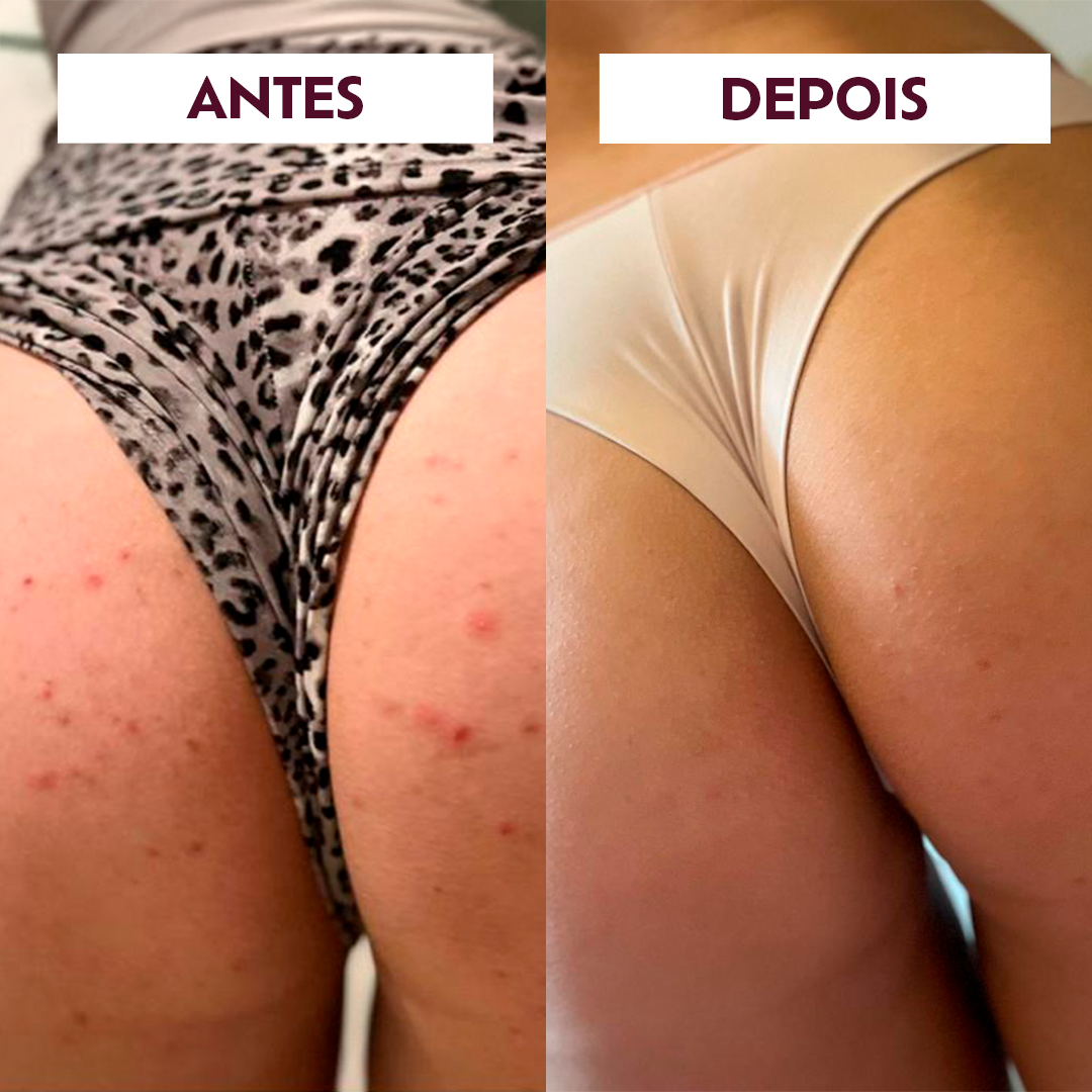 GEL ESFOLIANTE SUGAR UP — imagem 3