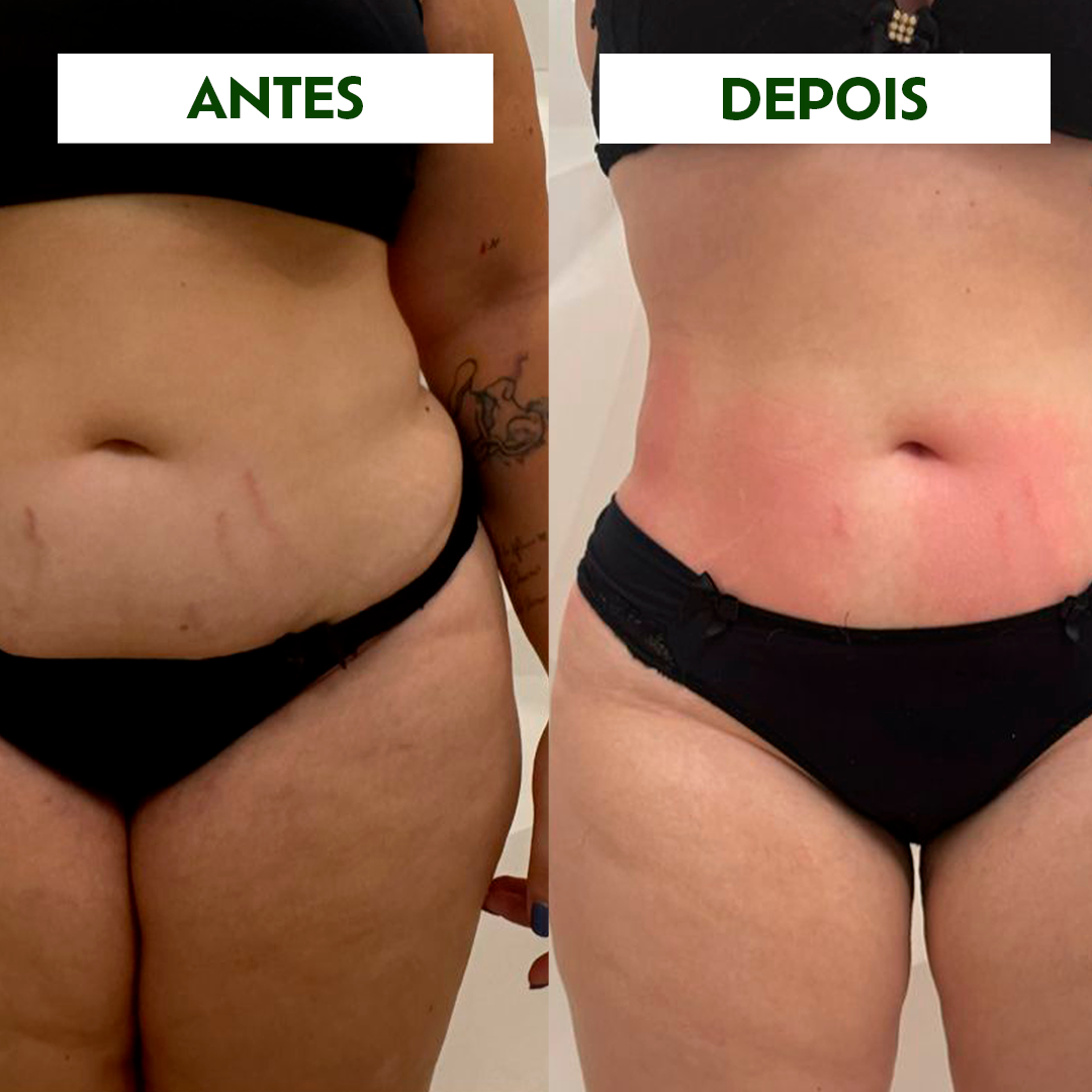 CREME REDUTOR E CLAREADOR FIT UP — imagem 3