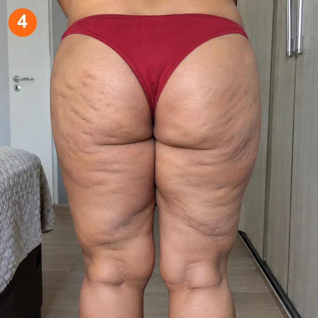Mista: quando é mais de um tipo ao mesmo tempo